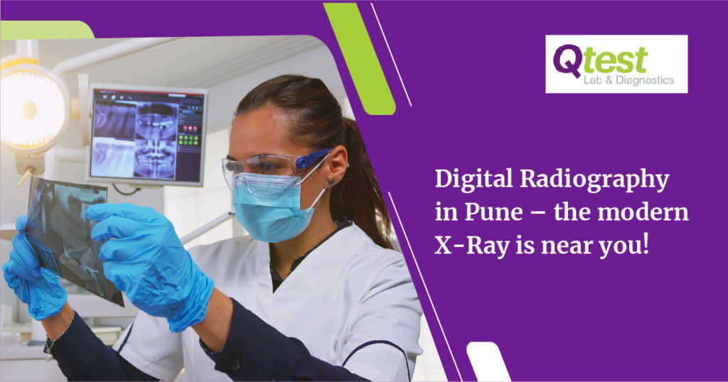 Digital X-Ray Lab in Kharadi