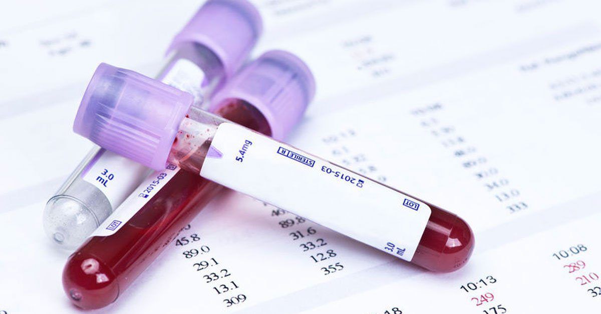 Blood Test Home Visit in Wadgaon Sheri | QtestDiagnostics