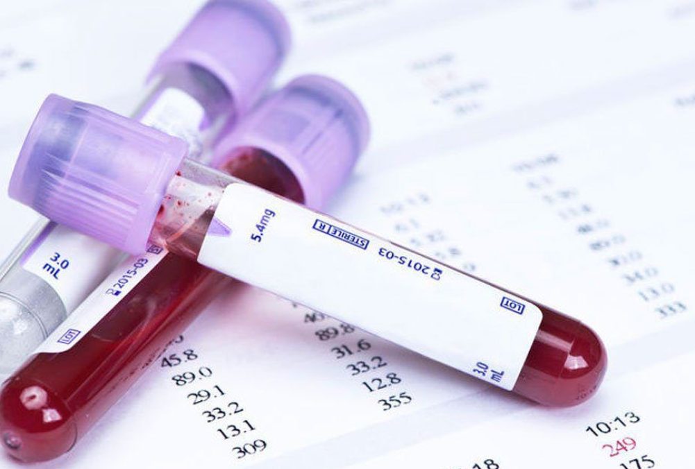Blood Test Home Visit in Wadgaon Sheri | QtestDiagnostics